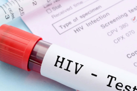 HIV