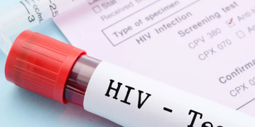 HIV